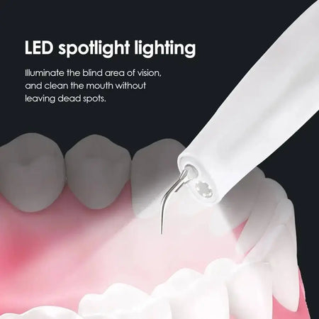 Ultrasonic Visual Dental Cleaning Teeth Whitening Kit Tartar - TikTokFavorites