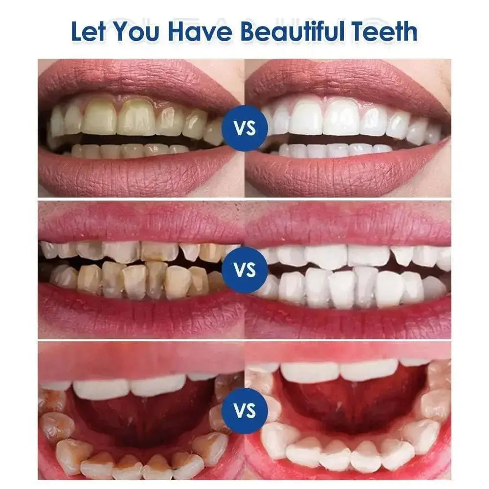 Ultrasonic Visual Dental Cleaning Teeth Whitening Kit Tartar - TikTokFavorites